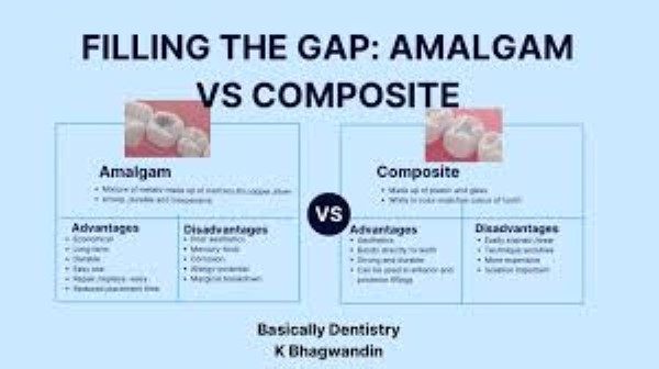 مقایسه کامپوزیت و امالگام