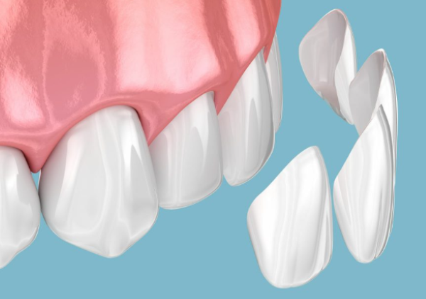 کامپوزیت های دندانی: تحولی شگفت‌انگیز در دندانپزشکی ترمیمی و زیبایی