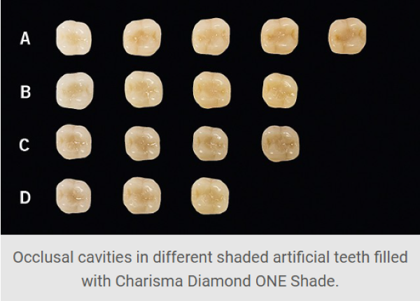  کامپوزیت کاریزما دایموند با فناوری T-Nano الماس‌مانند با ذرات پراکنده نانوپارتیکل، پلی بین زیبایی‌شناسی طبیعی و استحکام 