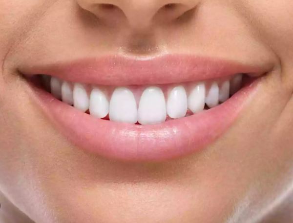 کامپوزیت‌های دندانی اهمیت امروز، چالش‌های فعلی و افق ۲۰۳۰