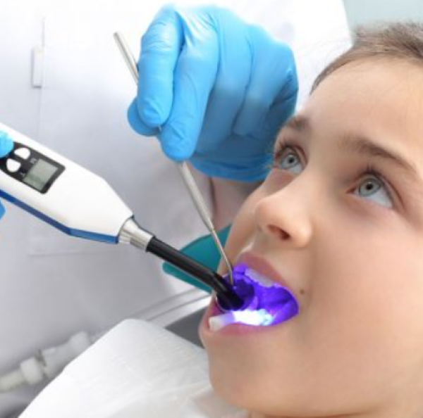 سیلانت فیشور؛ کلیدی برای نسل‌های عاری از پوسیدگی